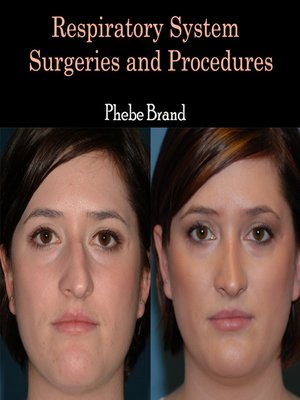 cover image of Respiratory System Surgeries and Procedures